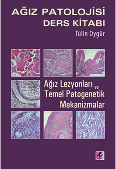 Ağız Patolojisi Ders Kitabı Ağız Patolojisi Ders Kitabı