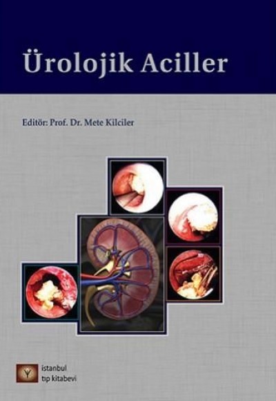 Ürolojik Aciller Ürolojik Aciller