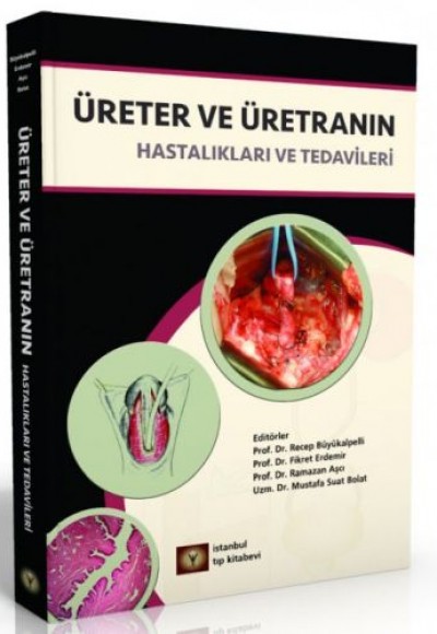Üreter ve Üretranın Hastalıkları ve Tedavileri Üreter ve Üretranın Hastalıkları ve Tedavileri