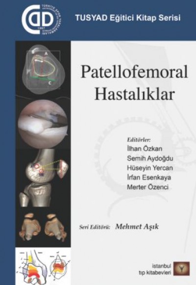 TUSYAD Eğitici Kitap Serisi - Patellofemoral Hastalıklar TUSYAD Eğitici Kitap Serisi - Patellofemoral Hastalıklar