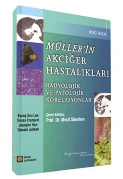 Müller’in Akciğer Hastalıkları - Radyolojik ve Patolojik Korelasyonlar Müller’in Akciğer Hastalıkları - Radyolojik ve Patolojik Korelasyonlar