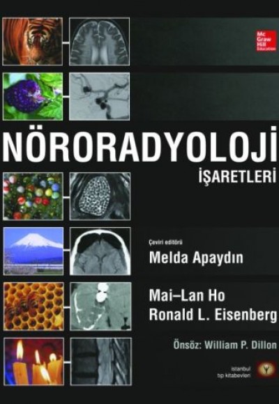 Nöroradyoloji İşaretleri (Ciltli) Nöroradyoloji İşaretleri (Ciltli)