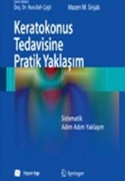 Keratokonus Tedavisine Pratik Yaklaşım Keratokonus Tedavisine Pratik Yaklaşım