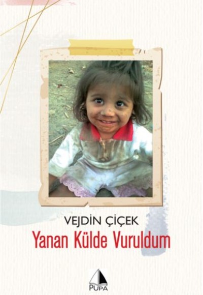 Yanan Külde Vuruldum