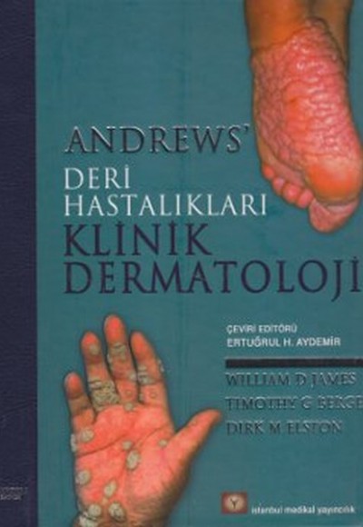 Andrew's Deri Hastalıkları Klinik Dermatoloji